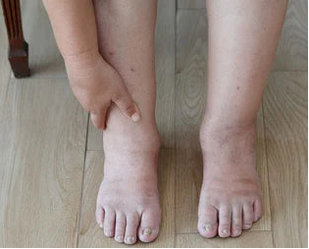 PIERNAS COMO PLOMO