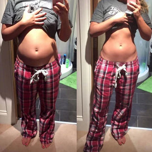 ABDOMEN DE EMBARAZADA